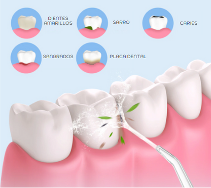 Irrigador Bucal Multifunción 🔥ESPECIAL DICIEMBRE 2X🔥