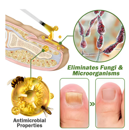 Suero para uñas con veneno de abeja-crecimiento y elimina hongos en 10 dias