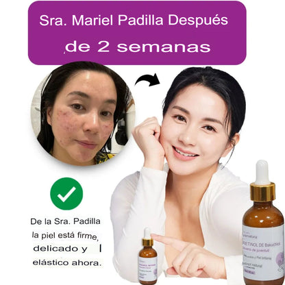 Suero rejuvenecedor con bakuchiol y retinol😍- Para acne, manchas y piel seca